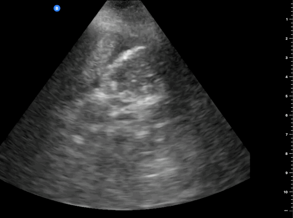 EEU case image missing